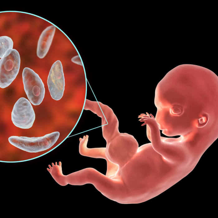 Toxoplasmose risques et précautions pendant la grossesse Les confidences de Céleste et Etoile